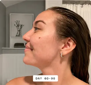Skin progress